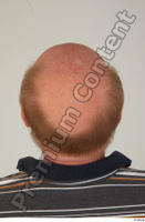  Street  831 bald hair head 0002.jpg